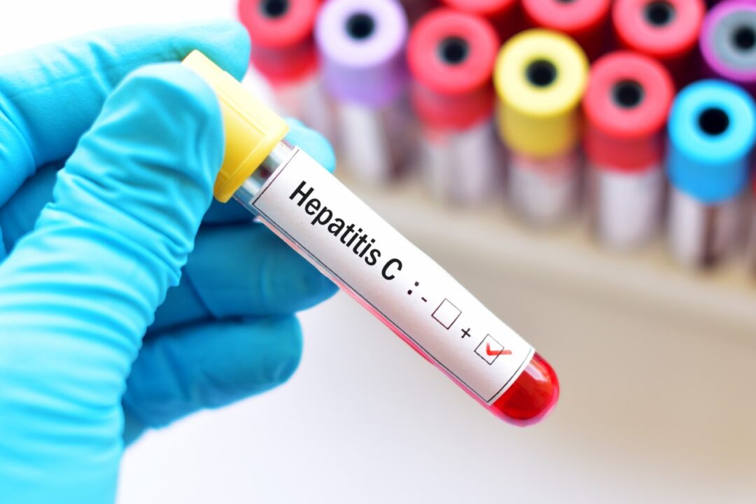 What Is Hepatitis C , Health Channel