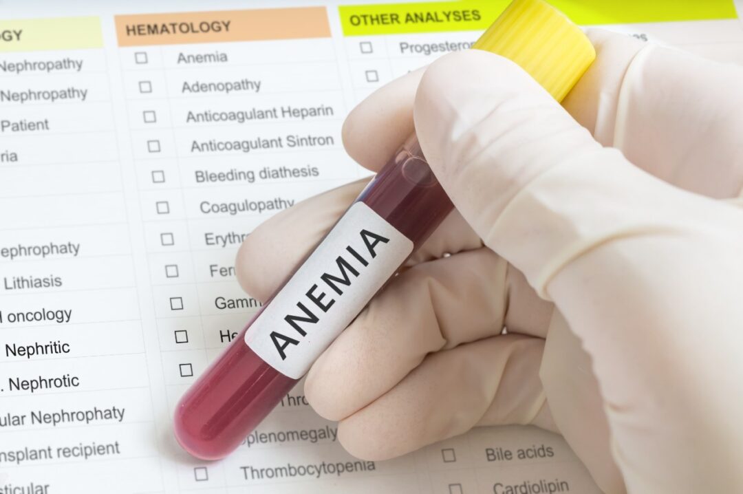 What Is Anemia , Health Channel