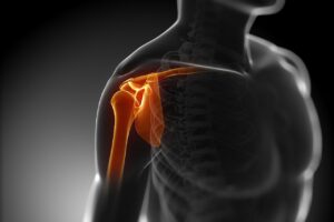 What causes my shoulder pain?