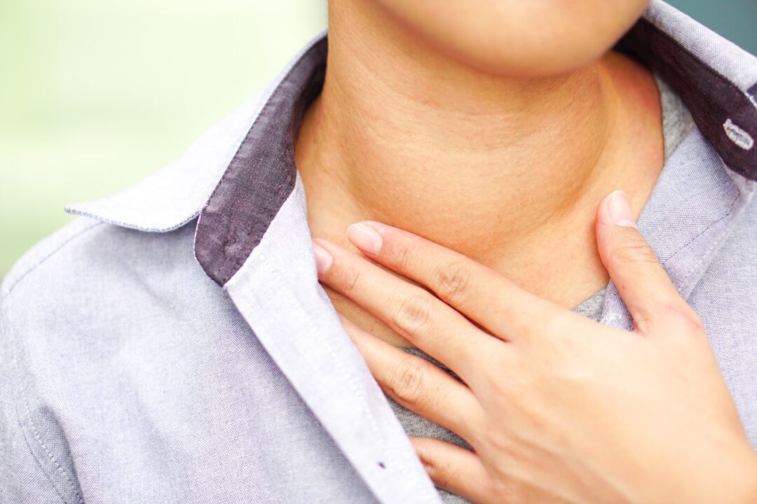 What is a goiter and what do you do about it?