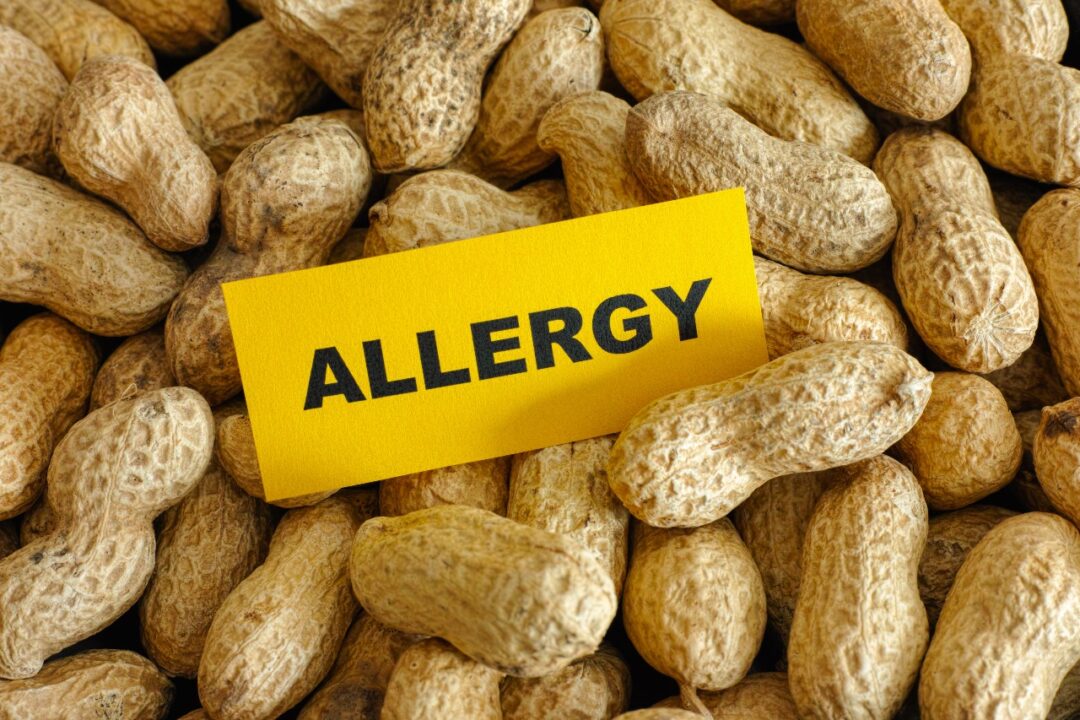 What is a peanut allergy?
