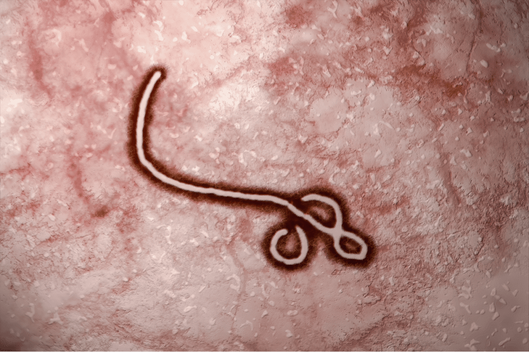What Is Supportive Care In Relation To Ebola Infections , Health Channel