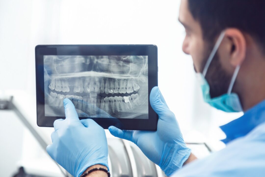 Why Do We Need Dental X Rays And How Often Should They Be Done , Health Channel