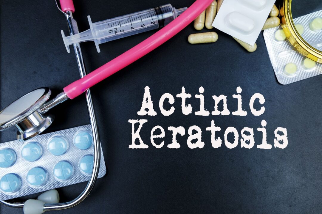 What Is Actinic Keratoses , Health Channel